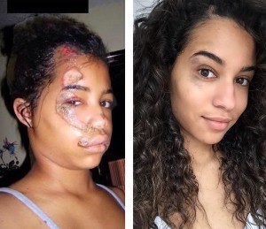 Sharlene Radlein Before &  After Accident - Photos from Sharlene Radlein Instagram Page