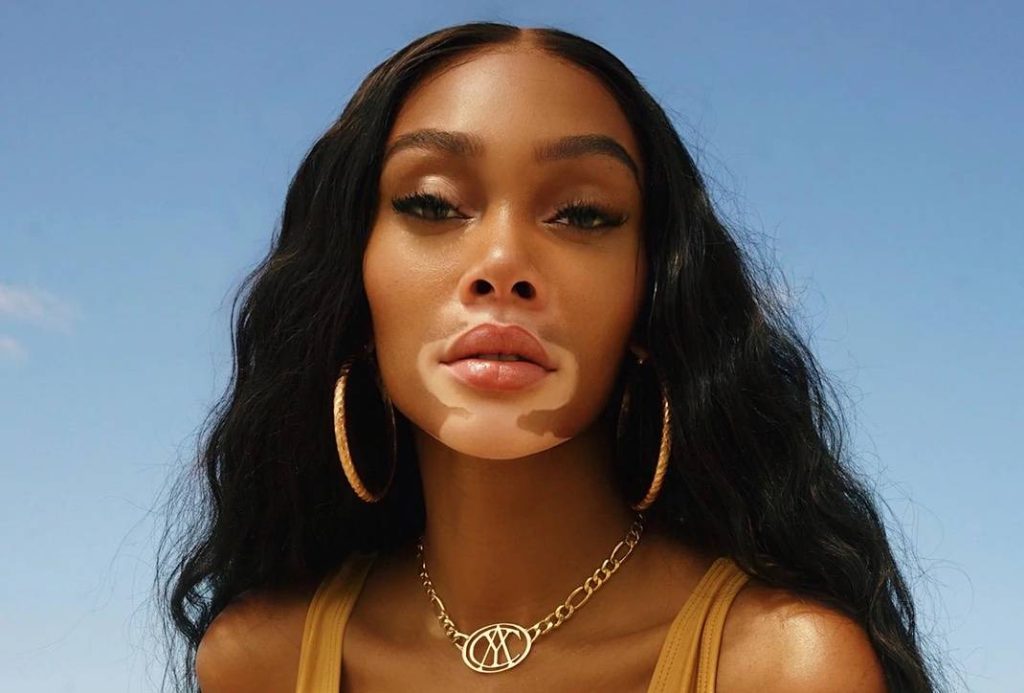 Jamaican heritage model Winnie Harlow