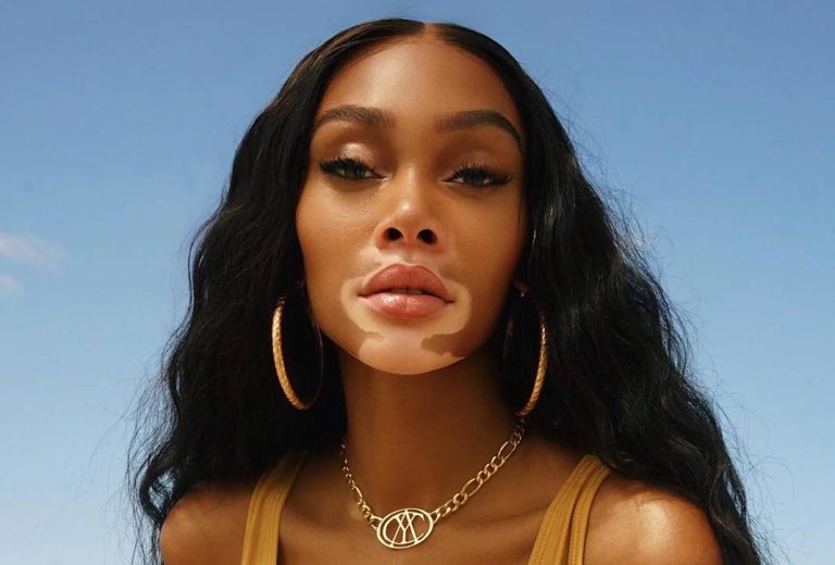Jamaican heritage model Winnie Harlow