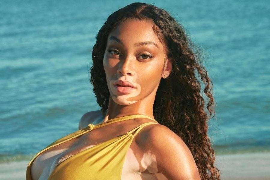 Model Winnie Harlow Launches Sunscreen Inspired by Her Jamaican Heritage