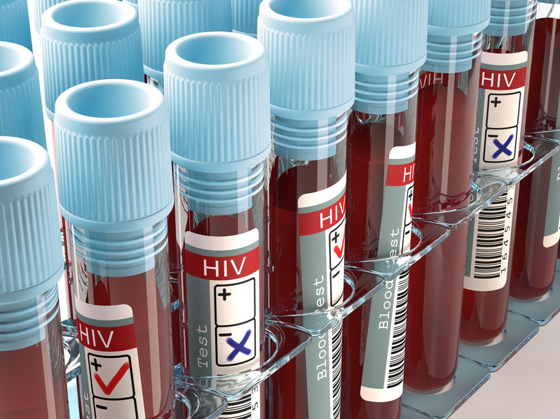 People Living with HIV should stay on treatment to fight Coronavirus