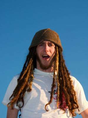 white jamaican with dreads